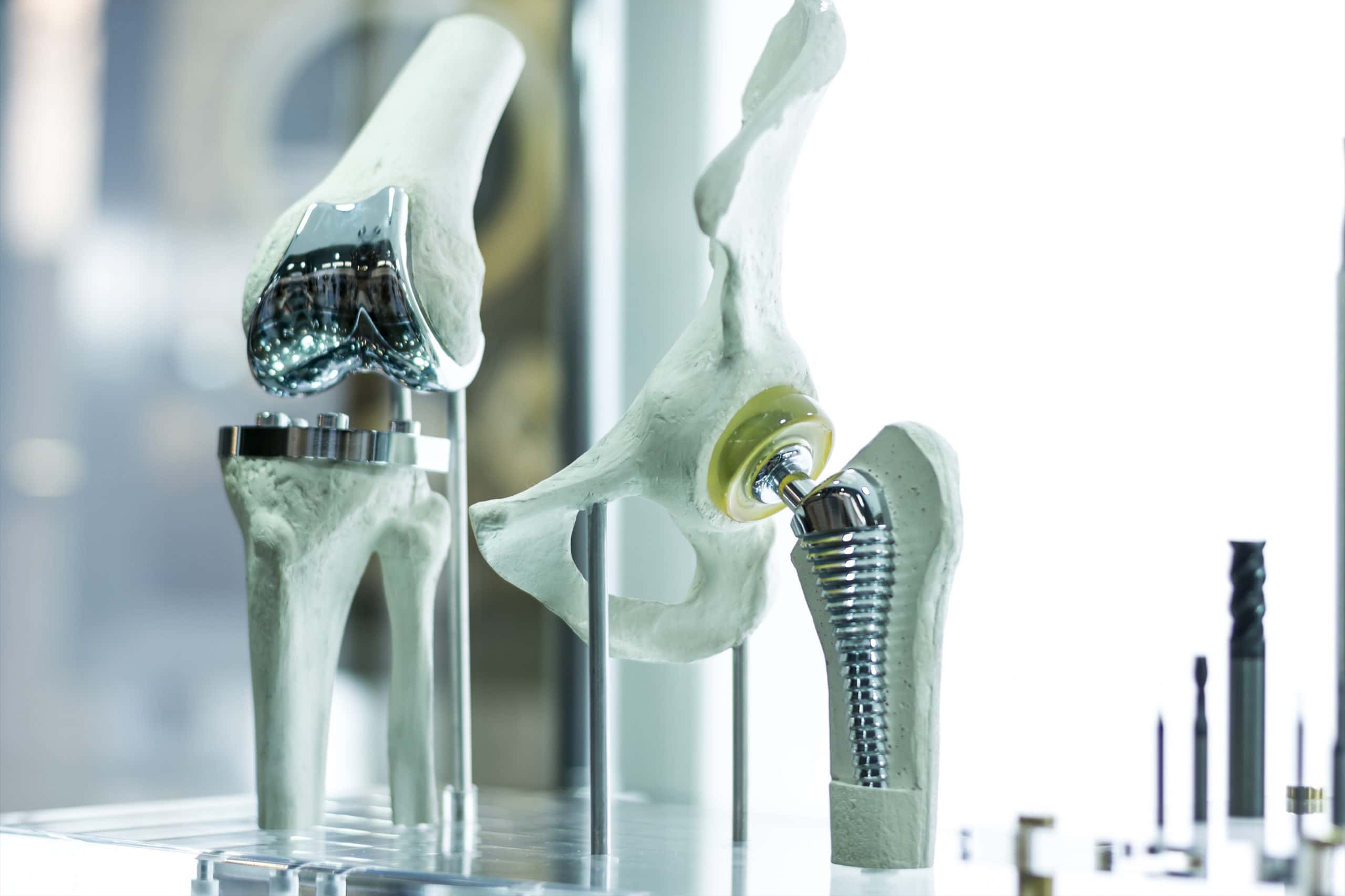 Modern knee and hip prosthesis made by cad engineer and manufactured by 3d printing