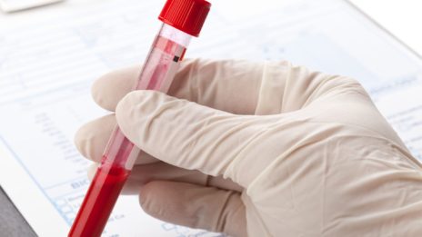 antibody testing in vial