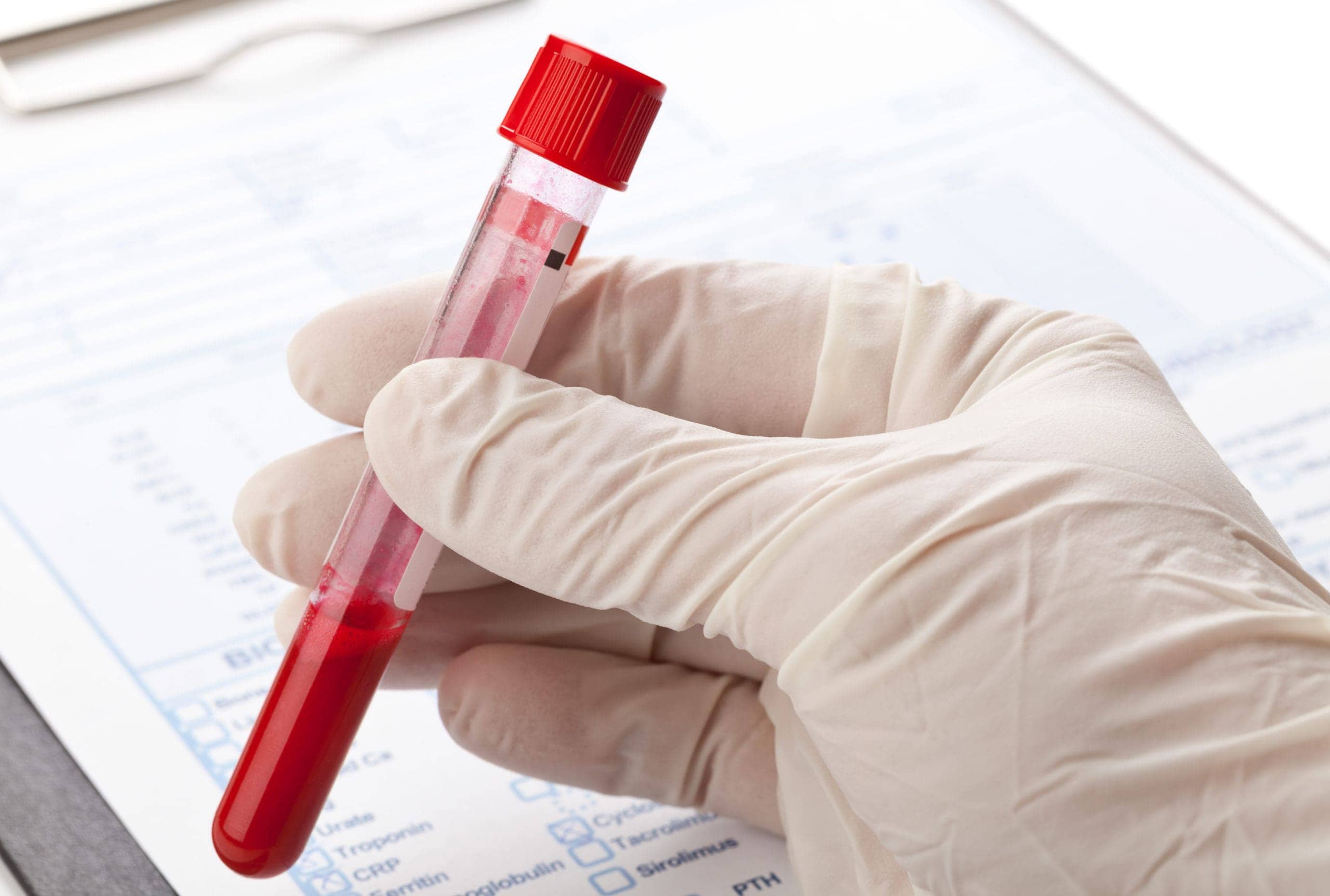 antibody testing in vial